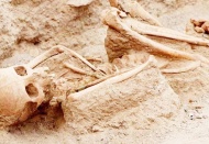 Bilim insanlarını şaşırtan gelişme: Çürük diş bulunmadı