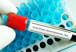 Bilim Kurulu üyeleri yanıtladı: Omicron varyantında ölüm olmaması umutlarımızı yeşertiyor"