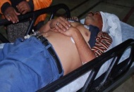 Bir kişi sopa ile darp edildi 