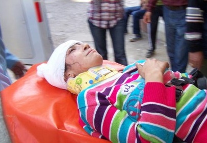 Bisikletten bir düşen çocuk yaralandı