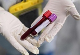 Boston Üniversitesi araştırması: D vitamini, Koronavirüs'ten ölüm riskini azaltıyor