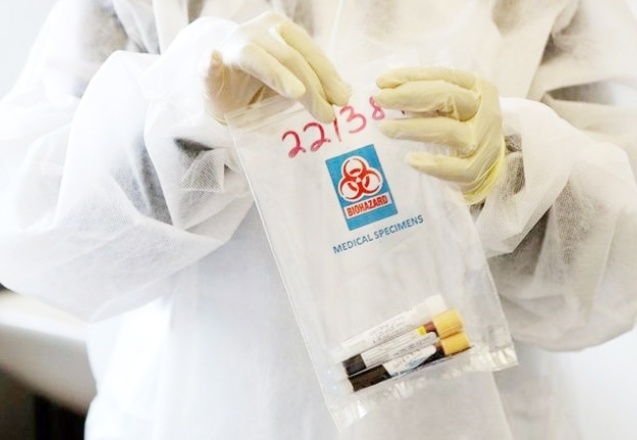 California'da Corona'nın daha tehlikeli yeni bir türü tespit edildi