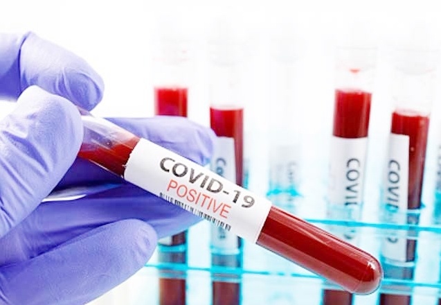 Coronavirus insan derisinde 9 saat kalabiliyor