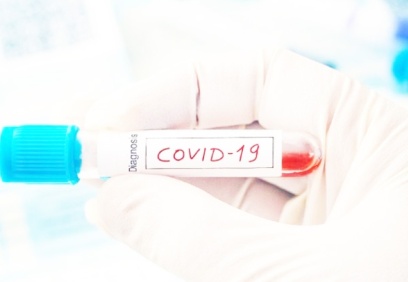 Covid-19 aşısında KDV oranı yüzde 1 oldu