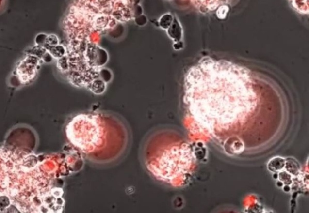 Covid-19'un beyindeki 48 saatlik yolculuğu görüntülendi