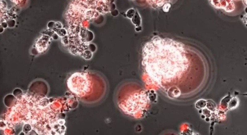 Covid-19'un beyindeki 48 saatlik yolculuğu görüntülendi