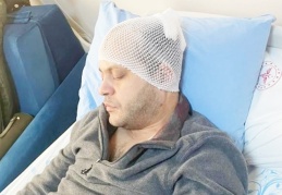 Doktorun kafasına 8 dikiş atıldı