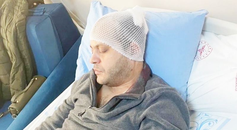 Doktorun kafasına 8 dikiş atıldı