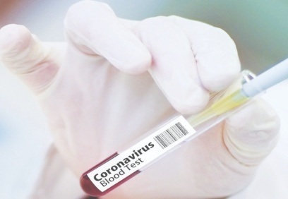 DSÖ: Covid-19 aşı sonuçları yıl sonunda ortaya çıkacak