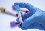 Dünya Sağlık Örgütü: Avrupa'da düşüş var Türkiye'de vakalar artıyor