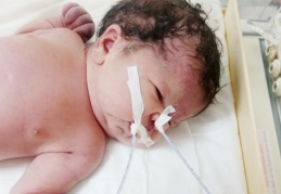 Elif Naz'ın tedavisini hiçbir hastane kabul etmiyor