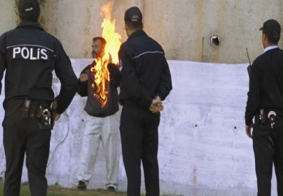 Eşiyle tartıştı, kendini yakmaya kalkıştı