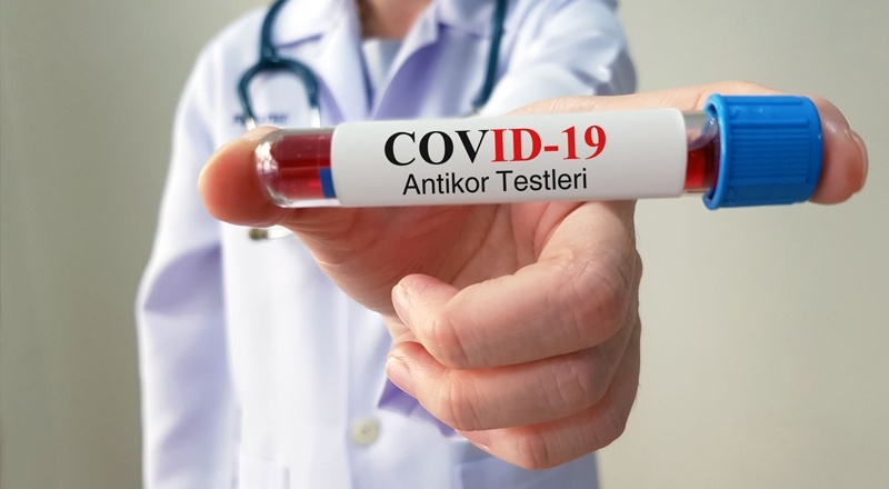 Gaziantep’te de antikor testi yapılacak
