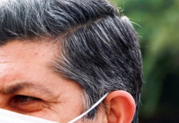 Gen tedavisiyle ileride saç beyazlamasının önüne geçilebilir