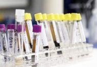 Gizemli hepatit vakaları 228'e yükseldi