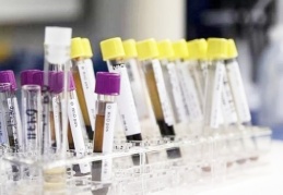 Gizemli hepatit vakaları 228'e yükseldi