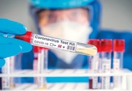 Günlük test sayısı giderek azalıyor