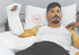 Hamur makinasına kaptırdığı eli, yerine dikildi