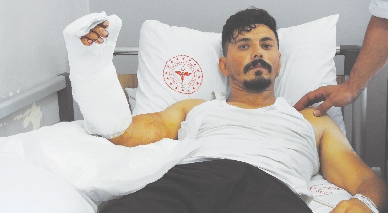 Hamur makinasına kaptırdığı eli, yerine dikildi