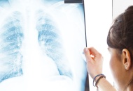 Her yıl 40 bin yeni vaka