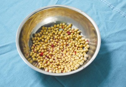 İdrar kesesi değil, taş ocağı!