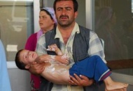 İki kardeşin üzerine kızgın yağ döküldü