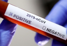 İMECE: AKP koronavirüste sınıfta kaldı!