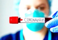 İnsanlık Koronavirüs'e karşı savaşı kaybetmeyecek