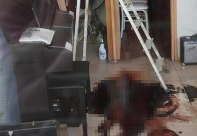 İşyerinde kafasına ateş edildi