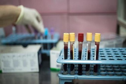 &#039;Kanser Türkiye&#039;de ikinci ölüm nedeni&#039;