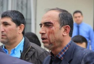 Kantin ihalesi deyip geçmeyin!