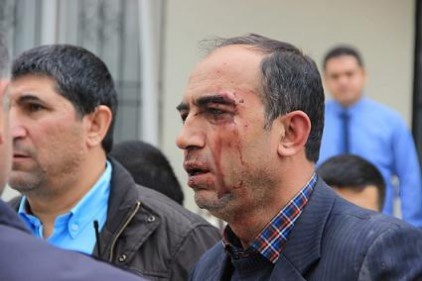 Kantin ihalesi deyip geçmeyin!
