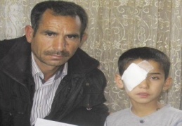 Kapı kolu kör etti