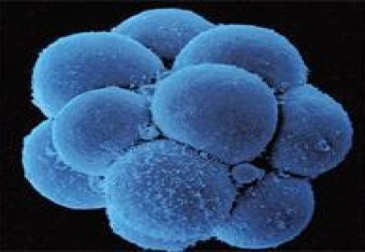 Kök hücre nakillerde başarı oranını artıracak