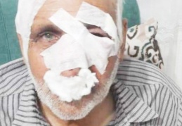 Köpeklerin saldırdığı 1 kişi öldü