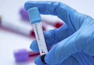 Koronavirüs döneminde 131 maç ertelendi