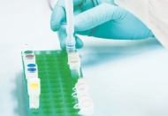 Koronavirüs için kullanılan ilaç tedavisi meclis gündeminde