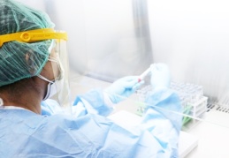 "Koronavirüs testlerinde pozitiflik oranı yüzde 30'dan 10'a düştü"