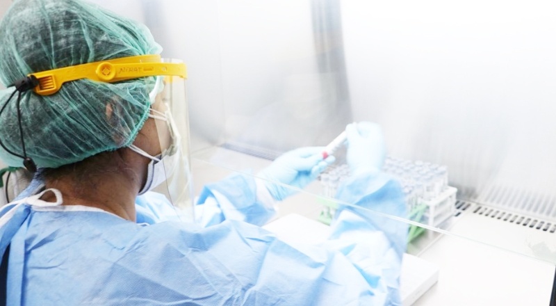 "Koronavirüs testlerinde pozitiflik oranı yüzde 30'dan 10'a düştü"