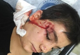 Küçük çocuğu köpeğin ağzından zor aldılar