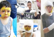 Mazot tenekesi bomba gibi patladı, 4 çocuk ölümden döndü