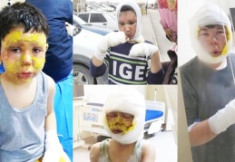 Mazot tenekesi bomba gibi patladı, 4 çocuk ölümden döndü