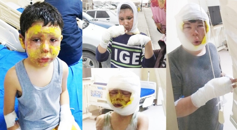 Mazot tenekesi bomba gibi patladı, 4 çocuk ölümden döndü