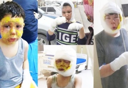 Mazot tenekesi bomba gibi patladı, 4 çocuk ölümden döndü