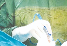 Mesanesinde 7 cm büyüklüğünde tümör çıktı