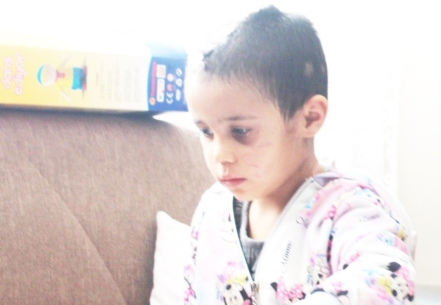 Minik Asiye'nin ilk ziyaretçisi Tahmazoğlu oldu