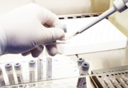 'Mutasyonlar koronavirüs vaka sayısını artırdı, en çok İngiltere mutasyonu görüldü'