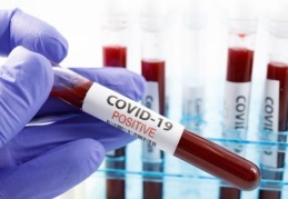 Nezle olana test yapılacak