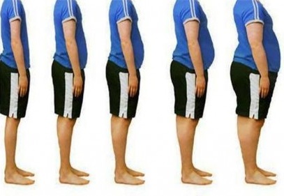 Nüfusun yüzde 17,2'si obez