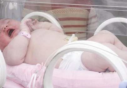 ''Obezite'' ile mücadele anne karnında başlıyor